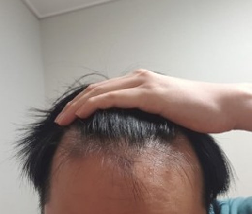 정면.jpg