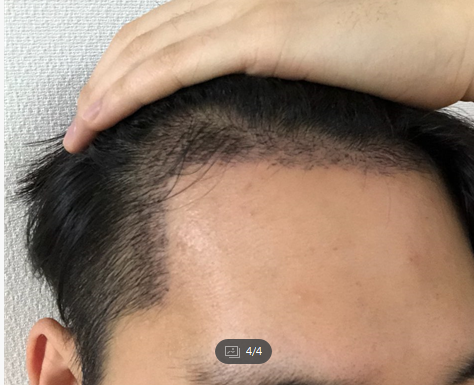 14일 122.png