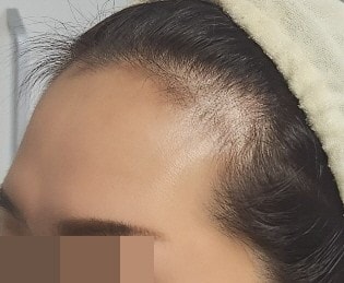꾸미기안현희_우_전.jpg