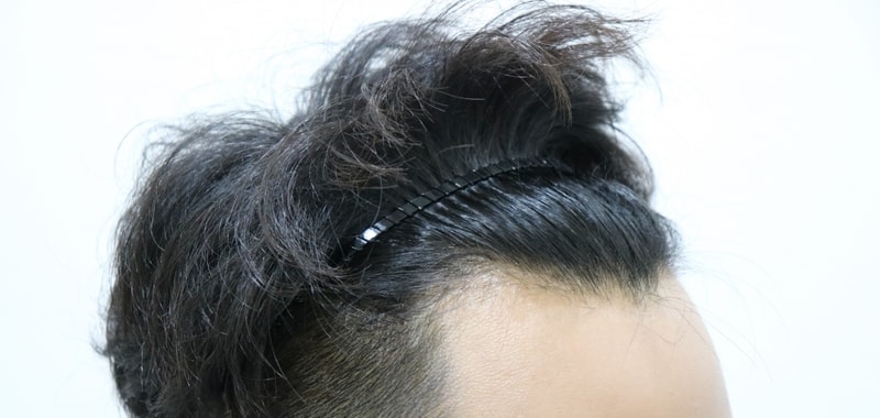 수술전1.jpg