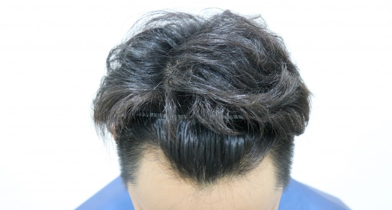 수술전2.jpg