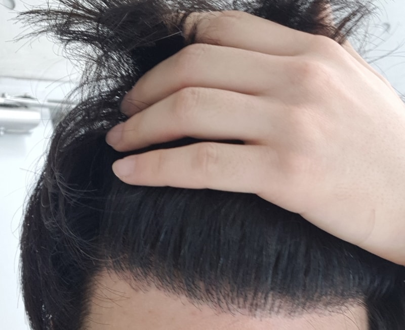 一年后照片