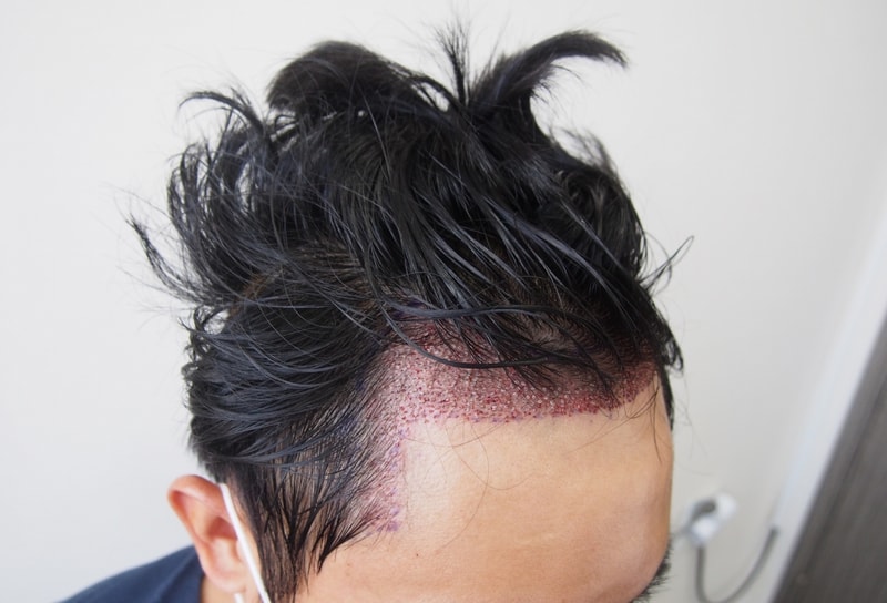 수술 후 2.jpg