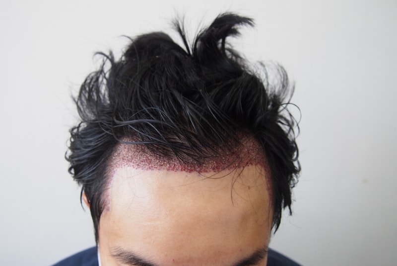 수술 후 1.jpg
