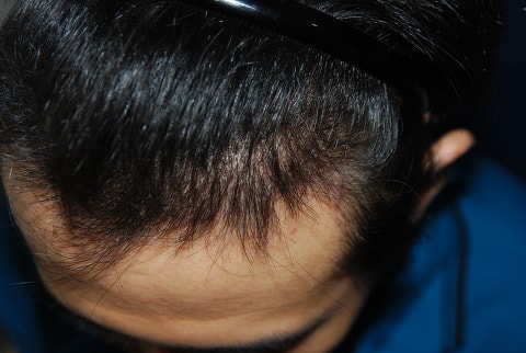 수술후1.jpg