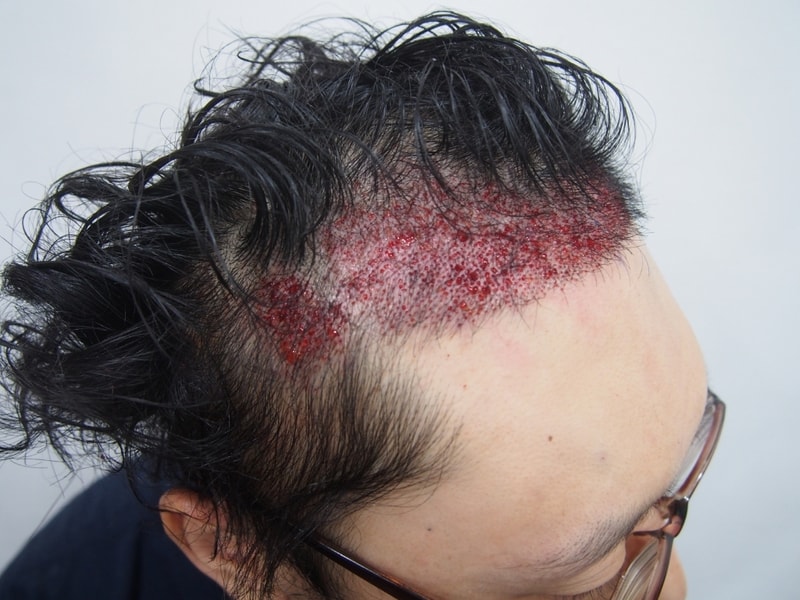 크기변환_수술후1.JPG
