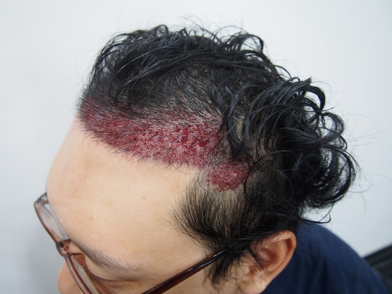 크기변환_수술후2.JPG