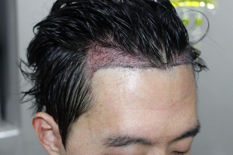 수술후2.jpg