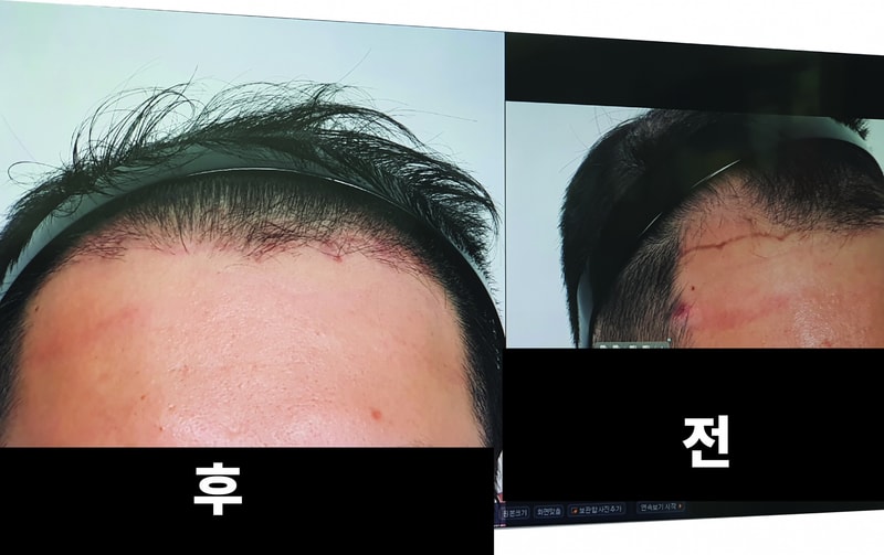 이마2-01-01.jpg