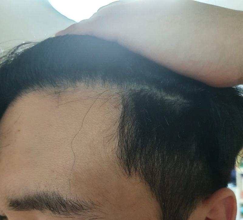 I'll leave a review for about 10 months