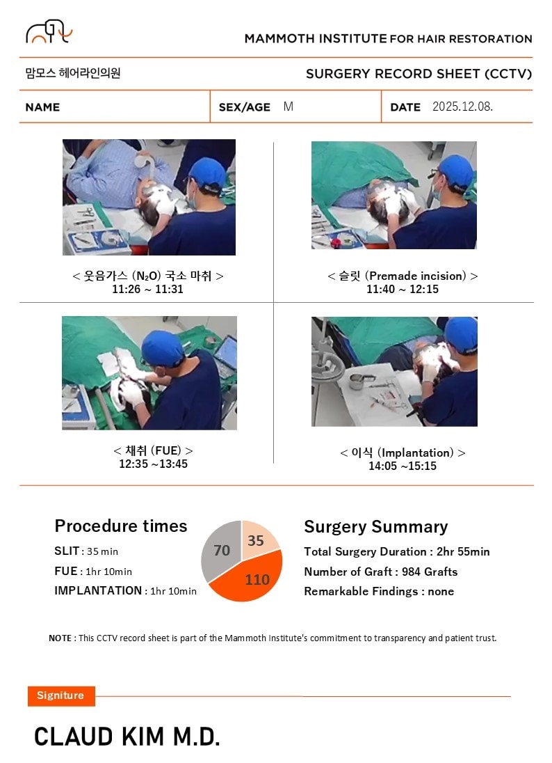 부산모발이식 슬릿방식 맘모스 M자 수술 당일 후기