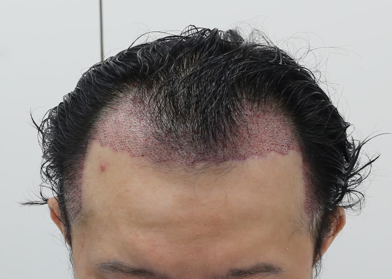 KakaoTalk_20250107_115635434_03.jpg
