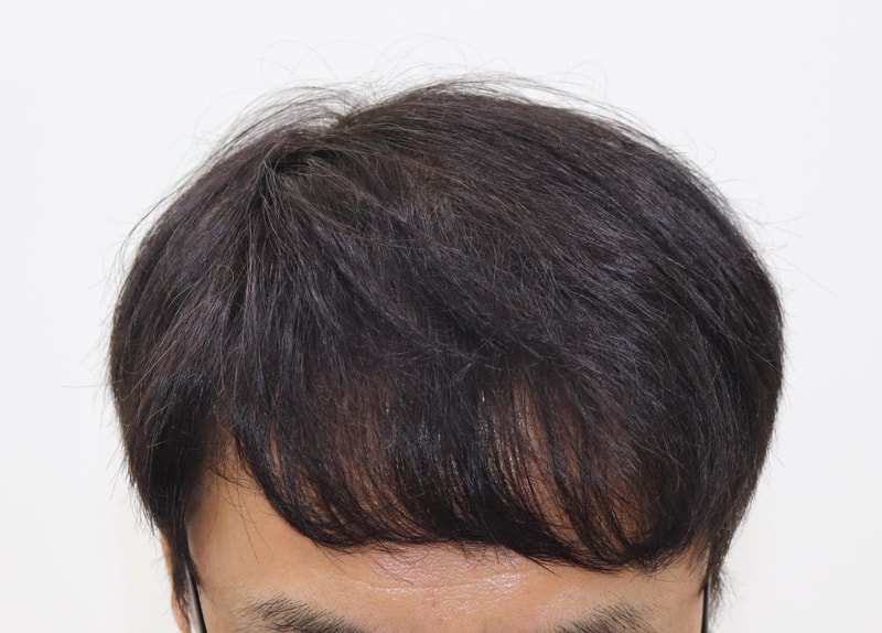 03.9개월차.JPG
