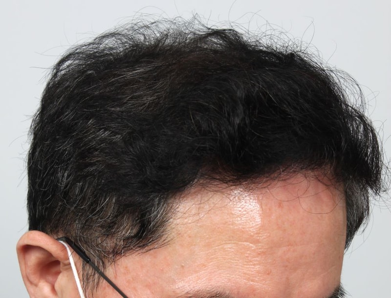 08.수술후.JPG