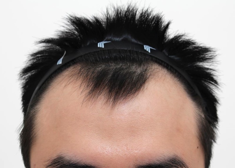 포토후기 이미지