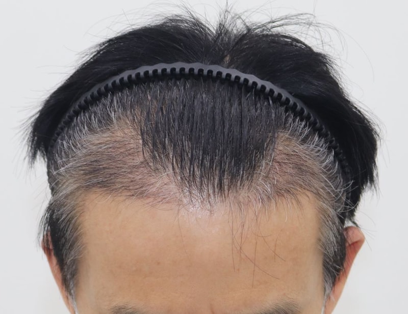 04,4개월차.JPG