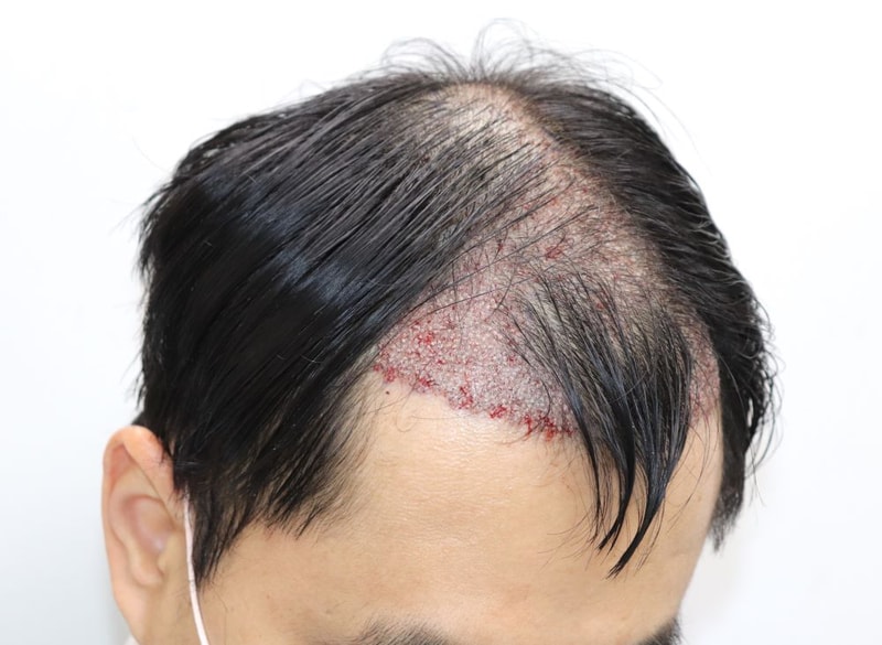 08.수술당일.JPG
