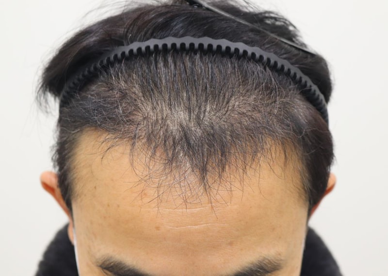 03.4개월.JPG