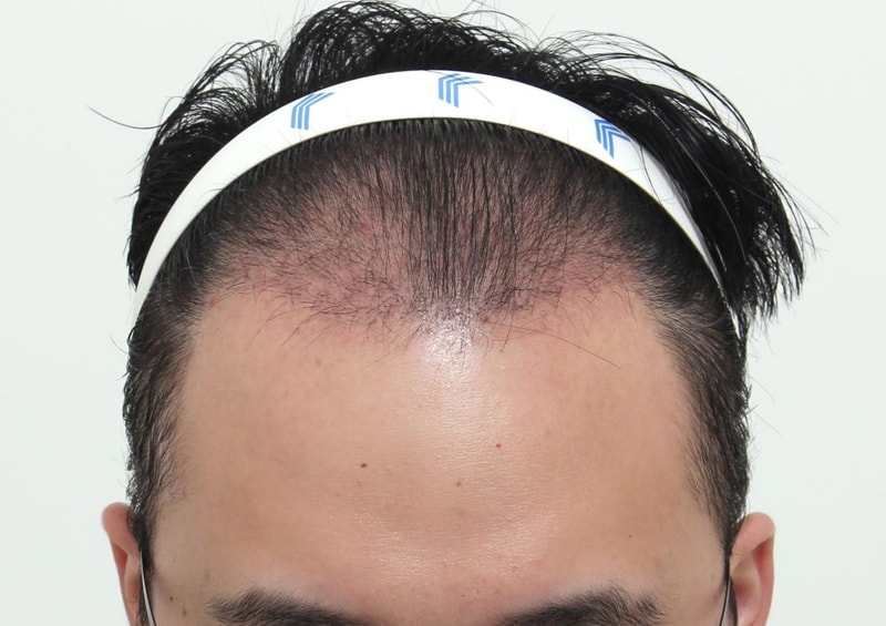 4.암흑기.JPG