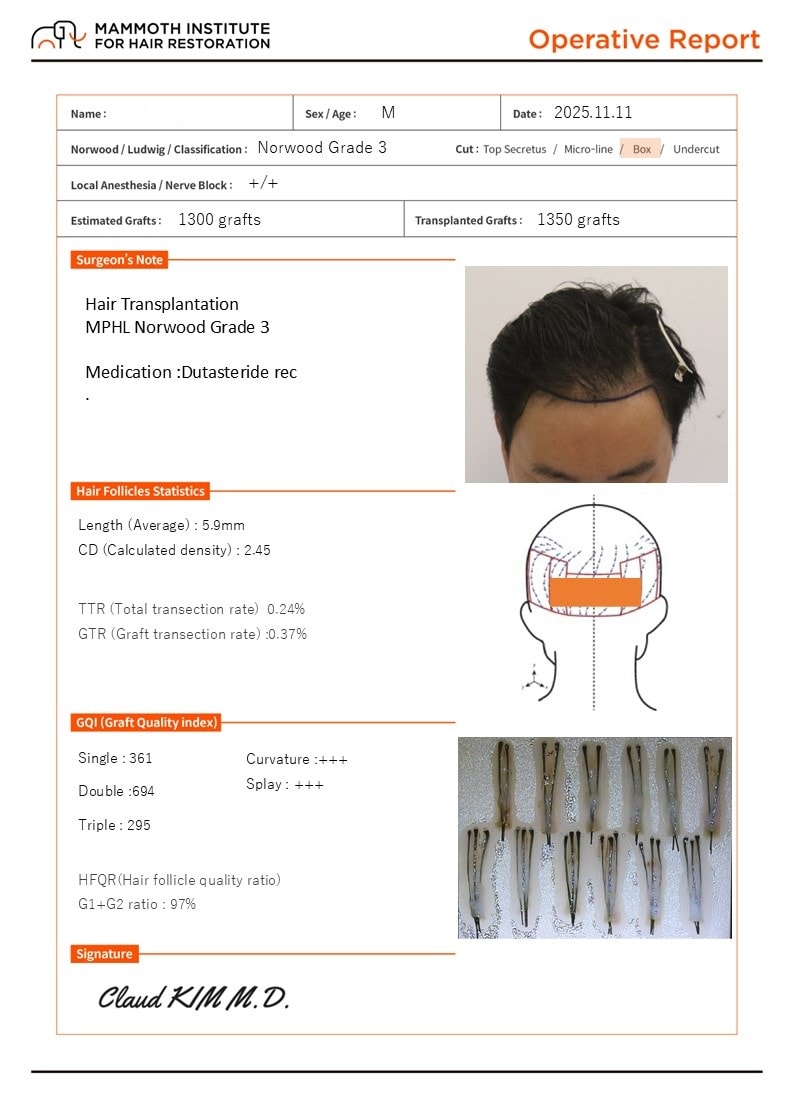 포토후기 이미지
