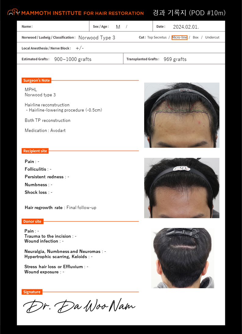 포토후기 이미지