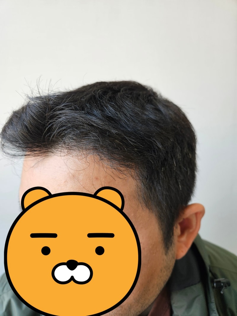 드디어 1년차에 쓰는 후기 입니다