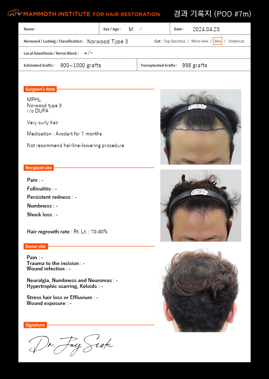 Apgujeong mammoth non-cut hair transplant is in the late 7 months.