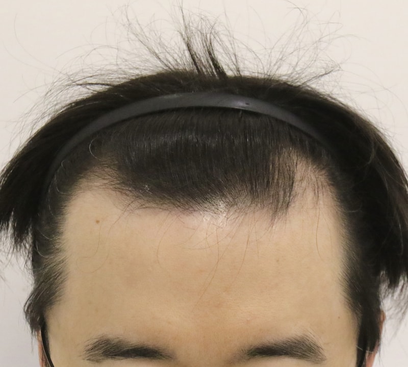 포토후기 이미지
