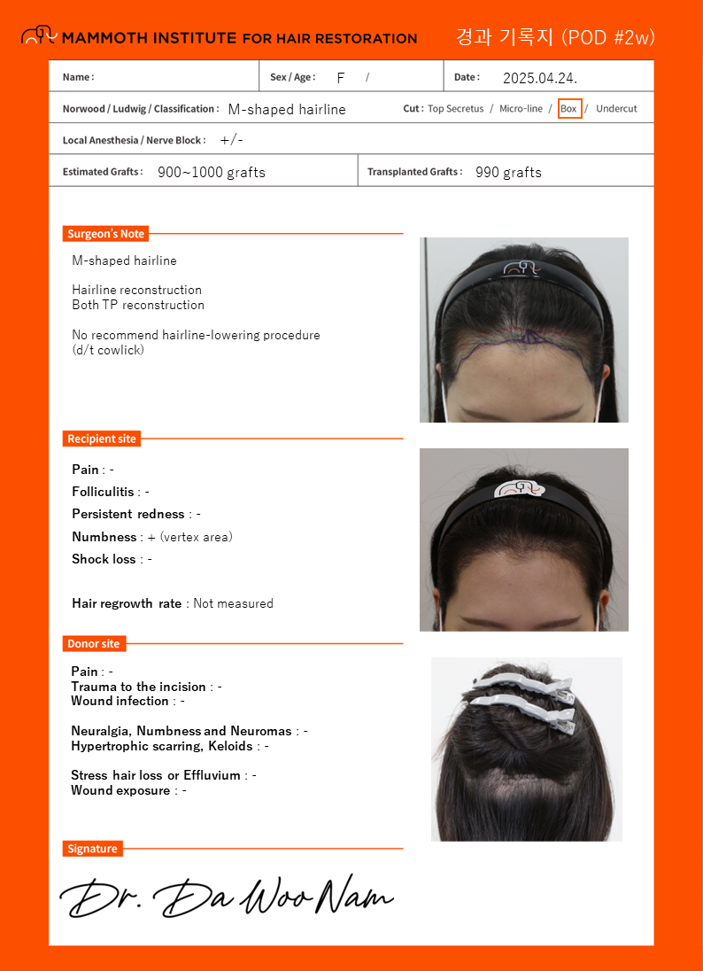 産毛維持スリット入りのヘアライン矯正 - ナム·ダウ院長手術