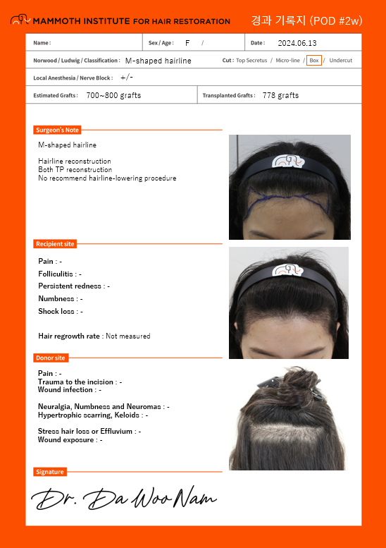 This is a review of non-cut diamond hair transplantation. (Mammoth Nam Dowoo)