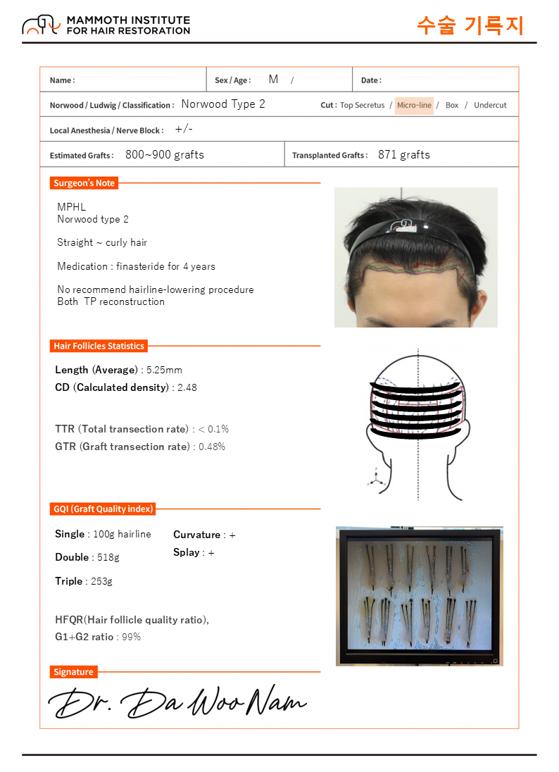 포토후기 이미지