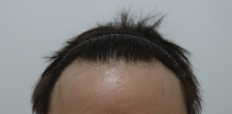 (Most) This is the photo after 2 weeks of non-intersection