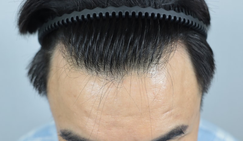 2주 지났는데 어떤가요?