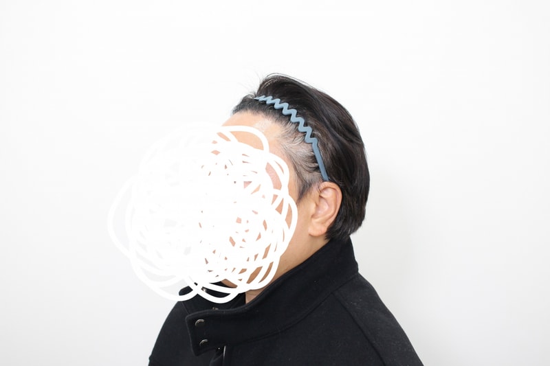 모프로의원 3888모 이식 7개월차 후기