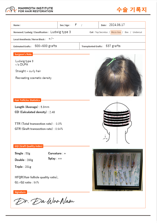 I left a review of the top of my head hair transplant from Apgujeong Mammoth Nam Da-woo.