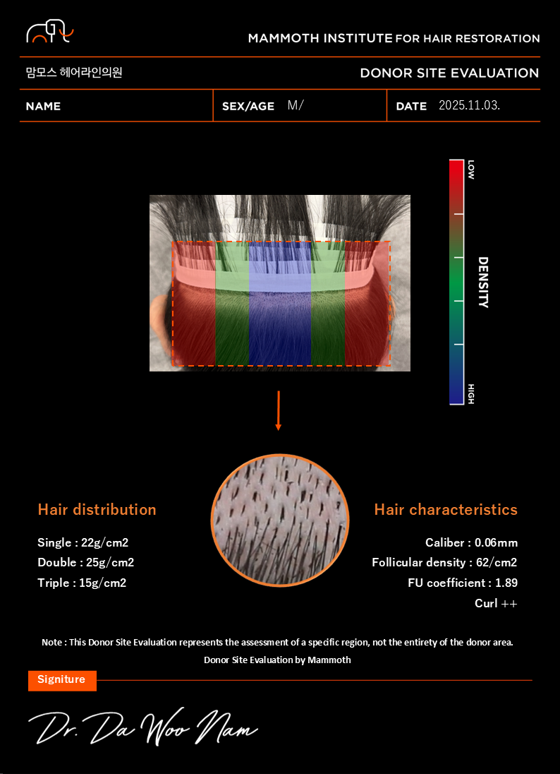 포토후기 이미지