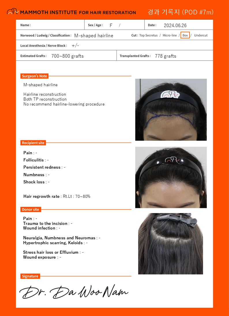 It's a pretty seven-month review after getting a non-cut hairline correction. (Apgujeong Mamos Nam Dowoo)