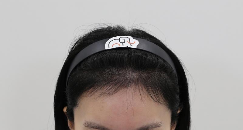 Apgujeong mammoth non-cut hair transplant is in the late 4 months. It's the best
