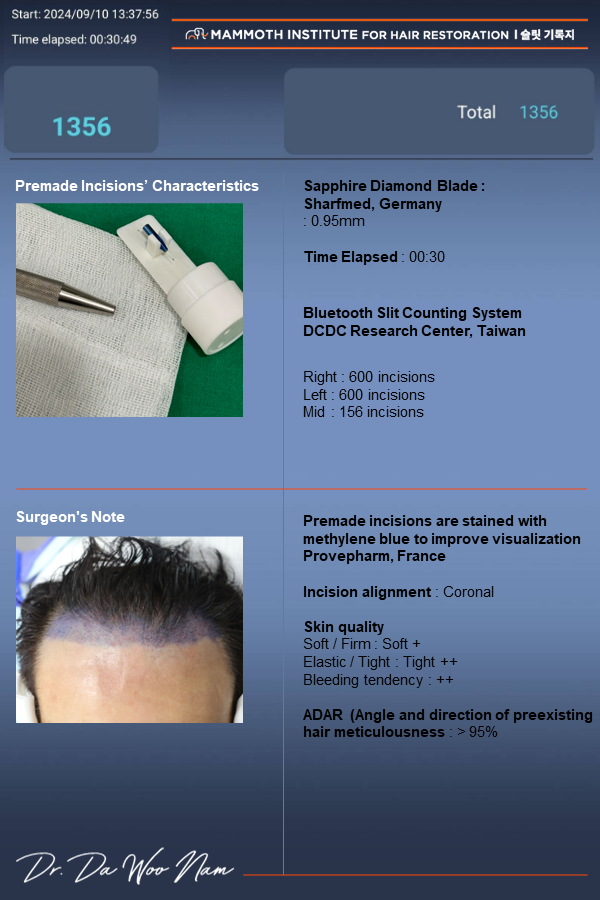 1356 hair follicle nasal incision transplant that's all gone. Thank you very much, Mr. Nam.