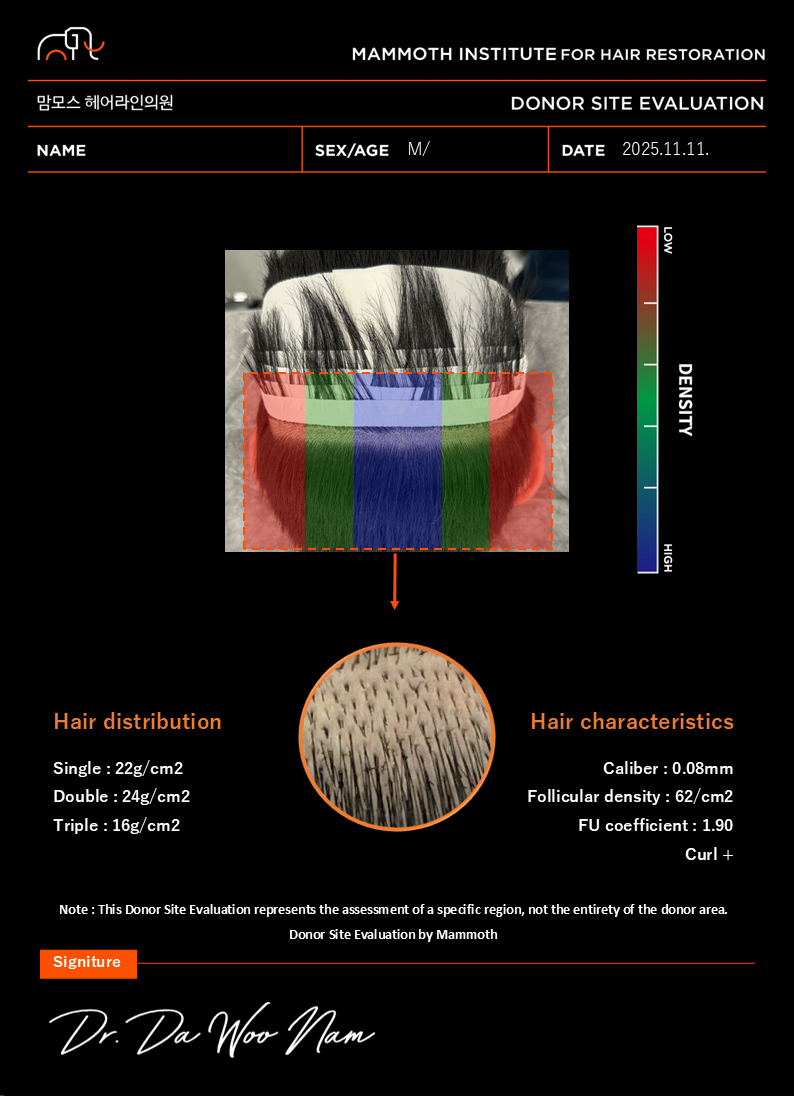 포토후기 이미지