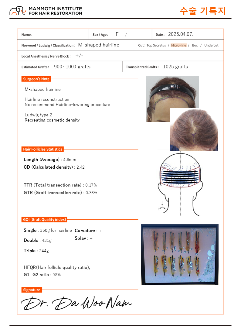 Mammoth Nam Da-woo's review of non-cut slit hairline + topical hair transplant.