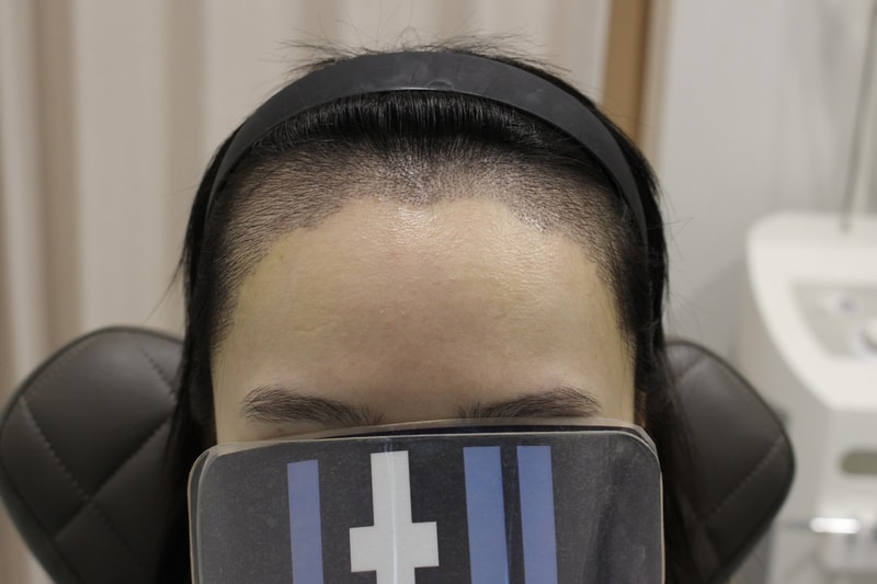 포토후기 이미지