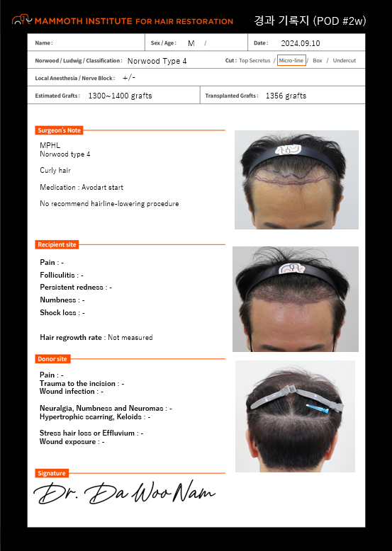 It's overwhelming. It's a review of Nam Dawoo's surgery to overcome all the lost bangs.