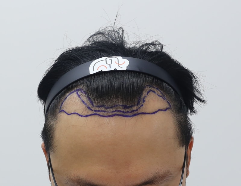 포토후기 이미지