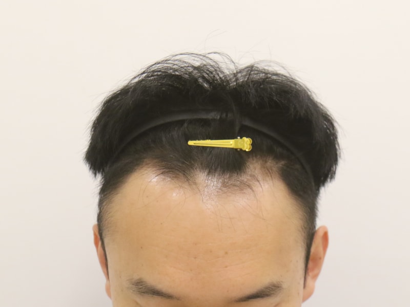 1000036542.jpg