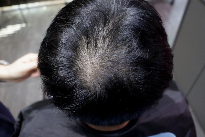 光州狎鸥亭Mobian医院2周后记