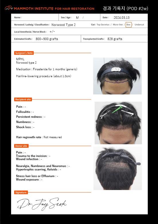 Seven months have passed since Apgujeong Mammoth Hairline.