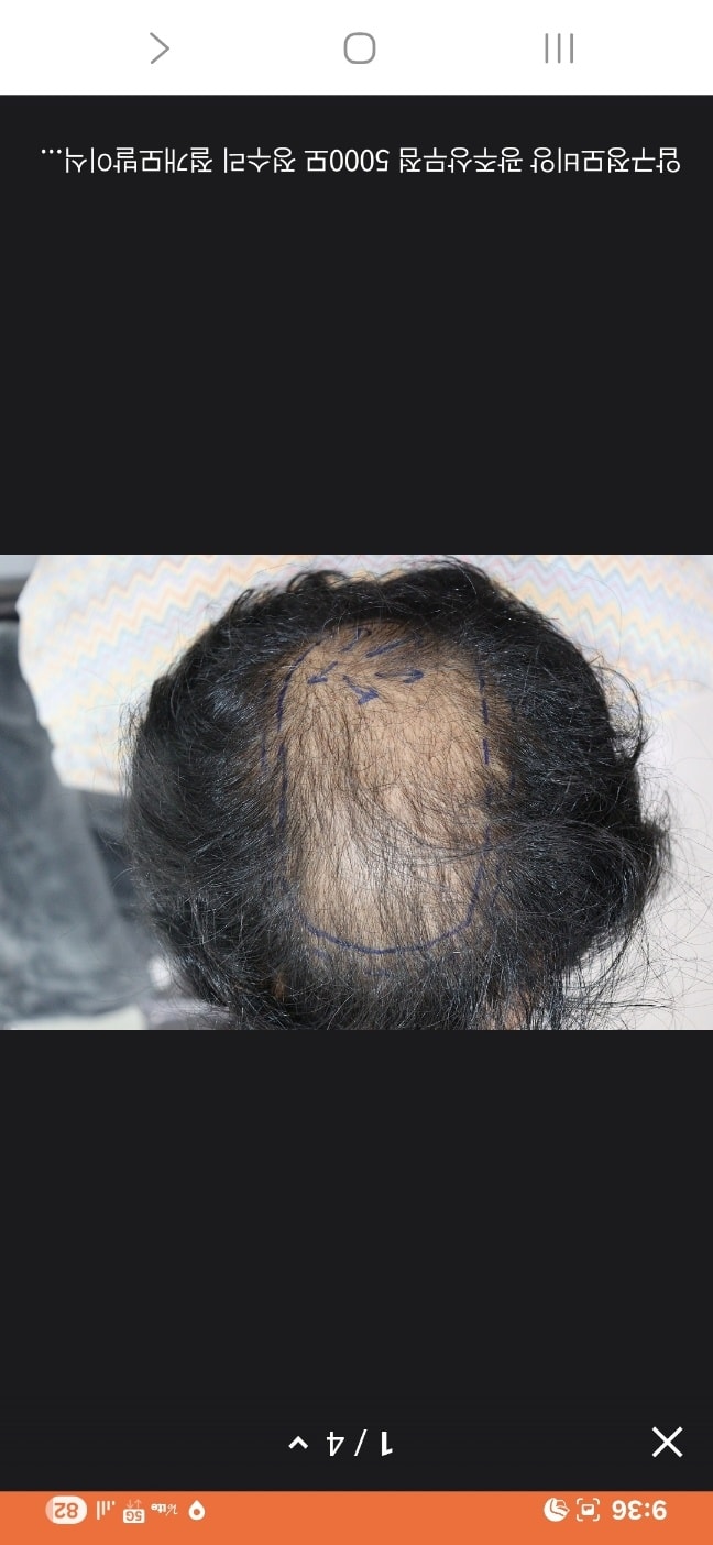 4개월차 어떤가요 전후