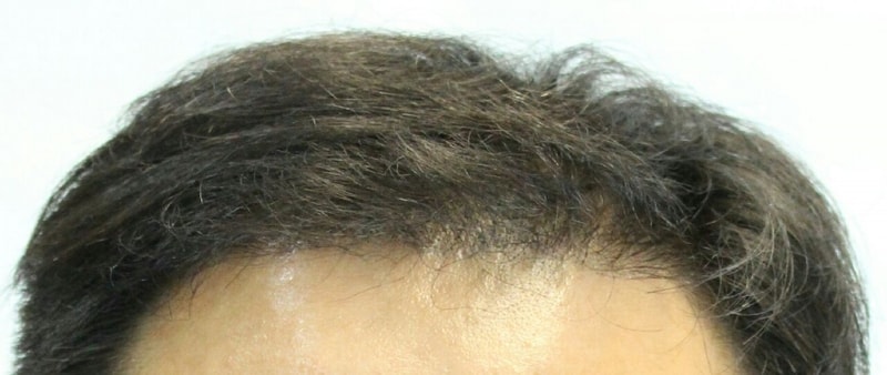 After.jpg