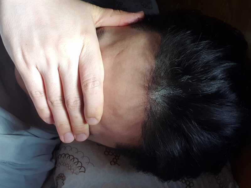 [모스트의원] 비절개 1600모낭 6개월차 후기입니다.